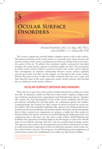 Ocular Surfaces Article 2